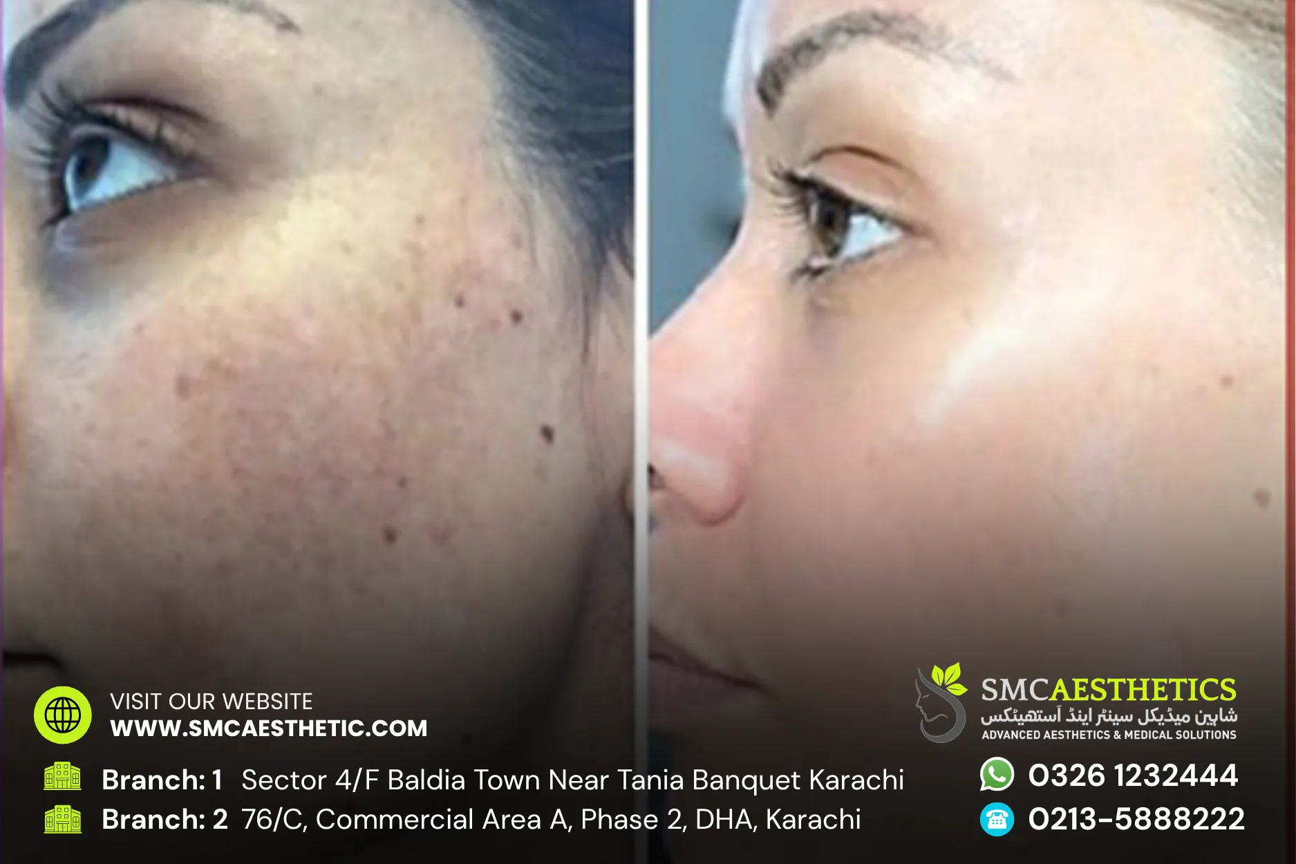 Before After Results