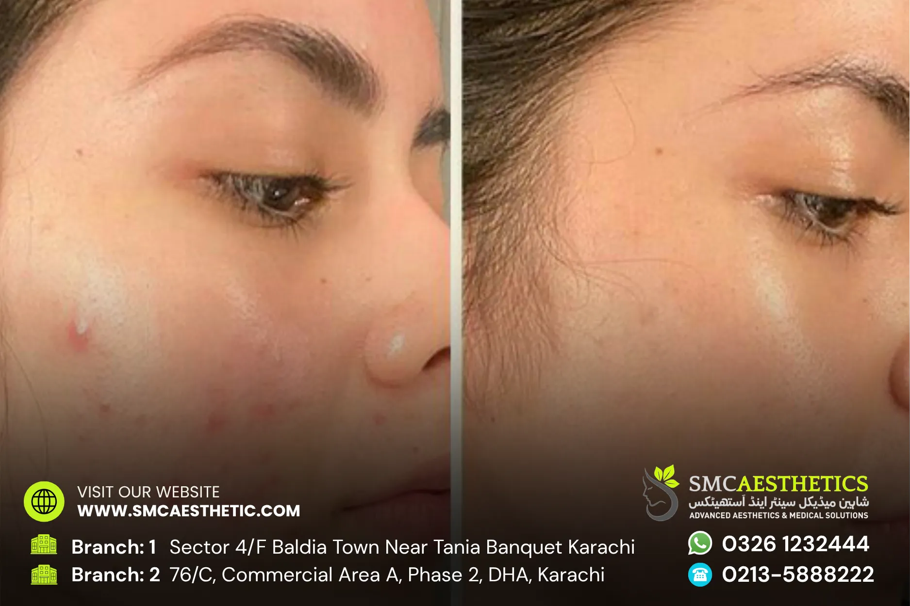 Before After Results
