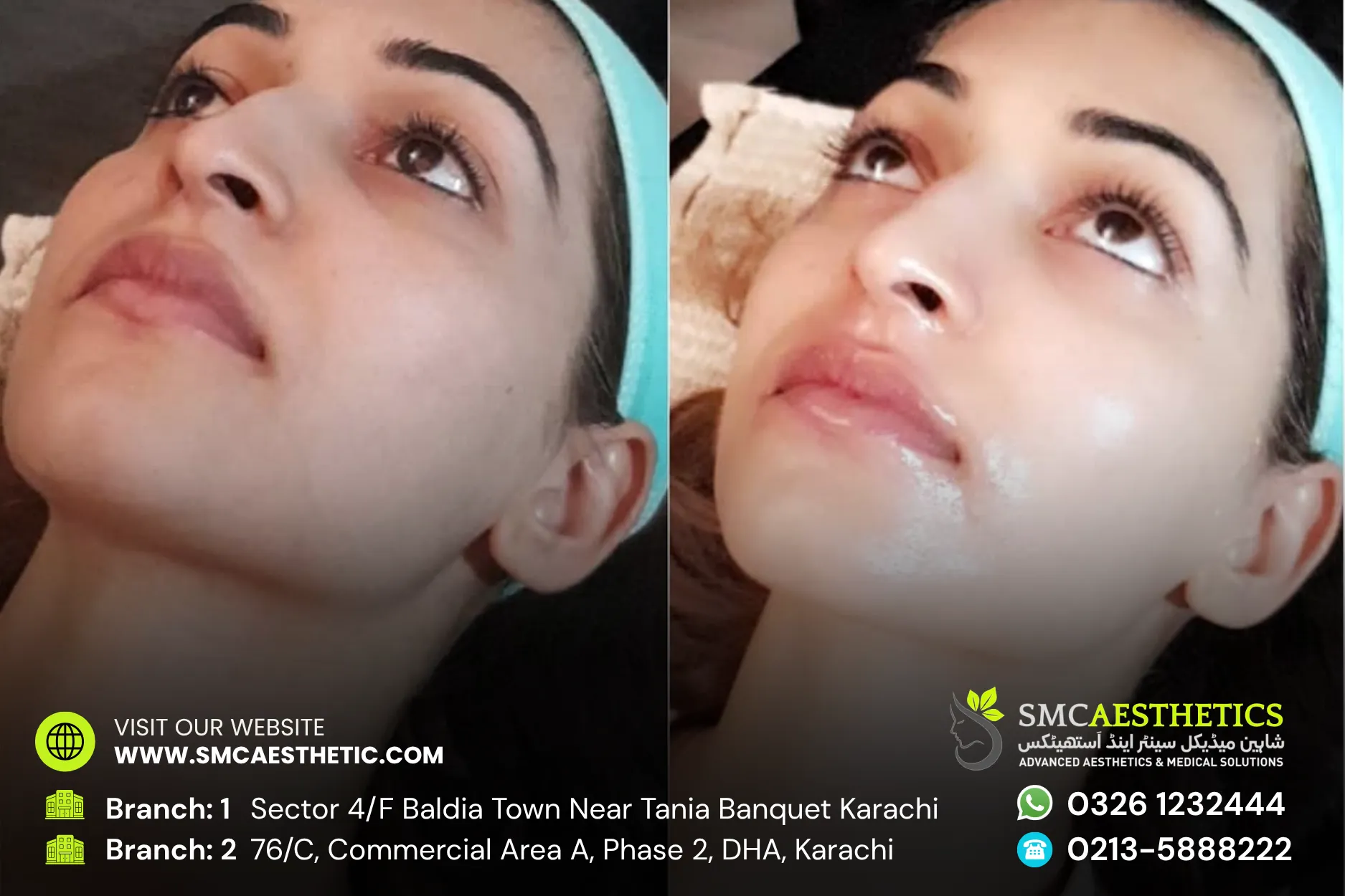 Before After Results