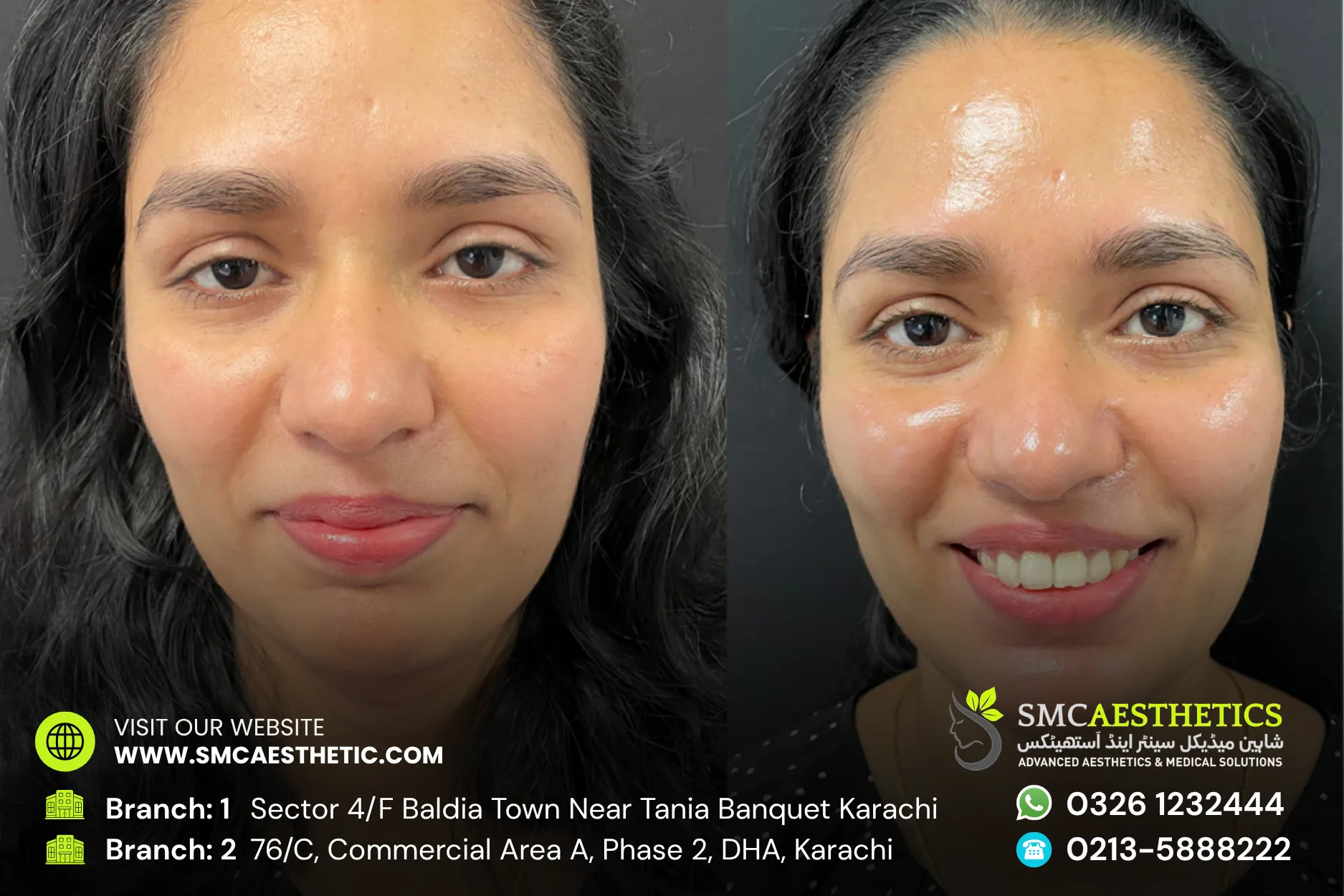 Before After Results