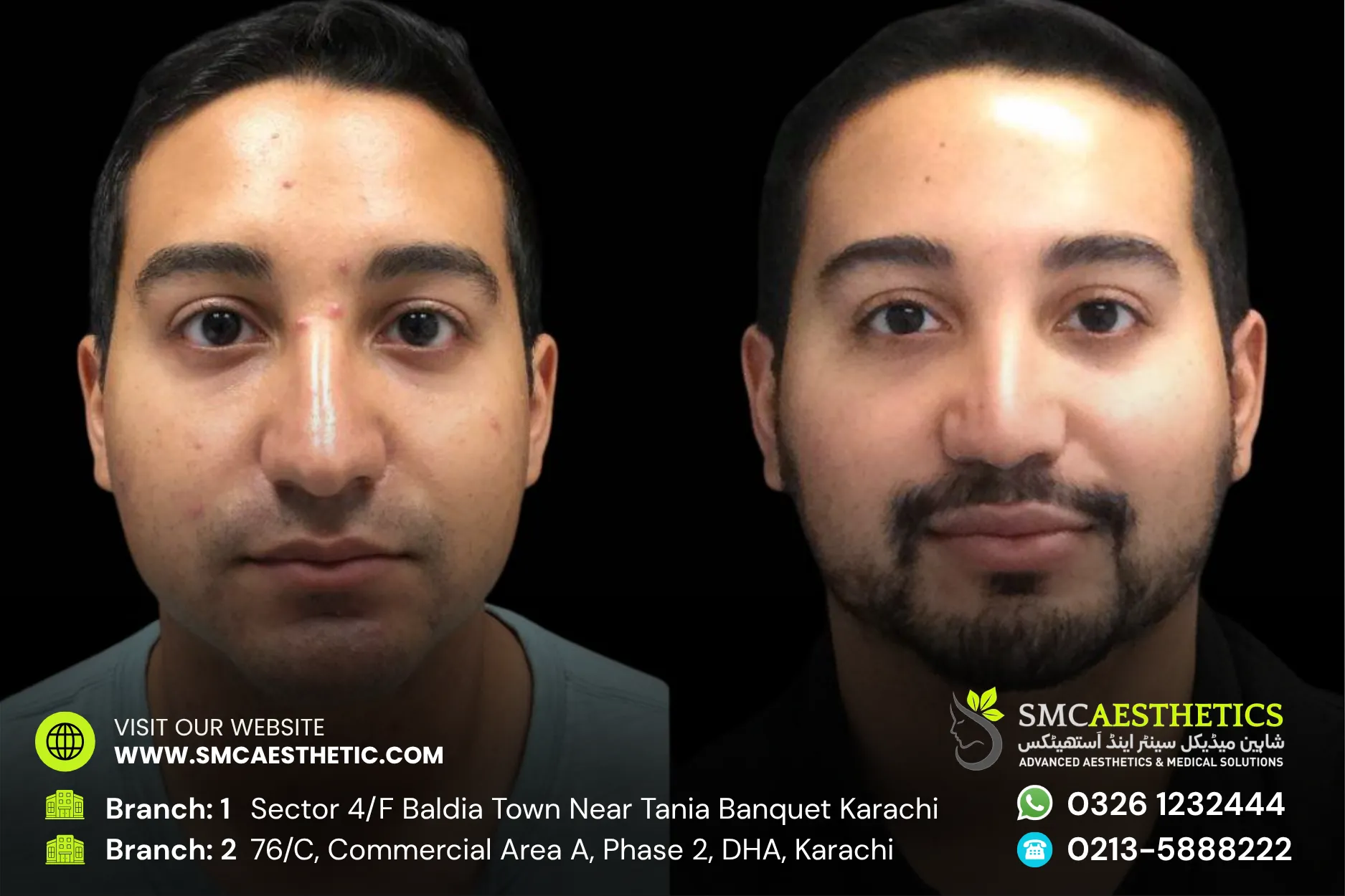 Before After Results