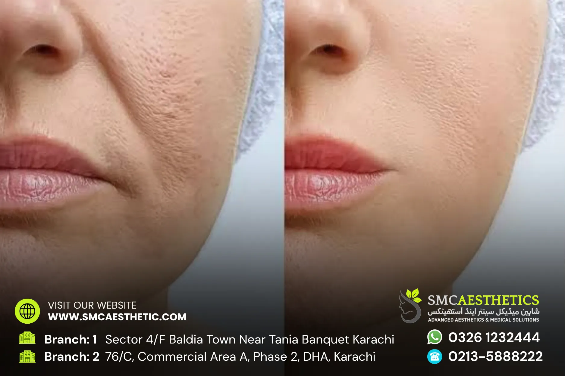 Before After Results