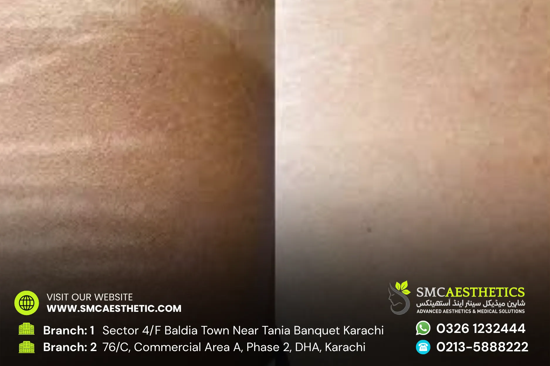 Before After Results