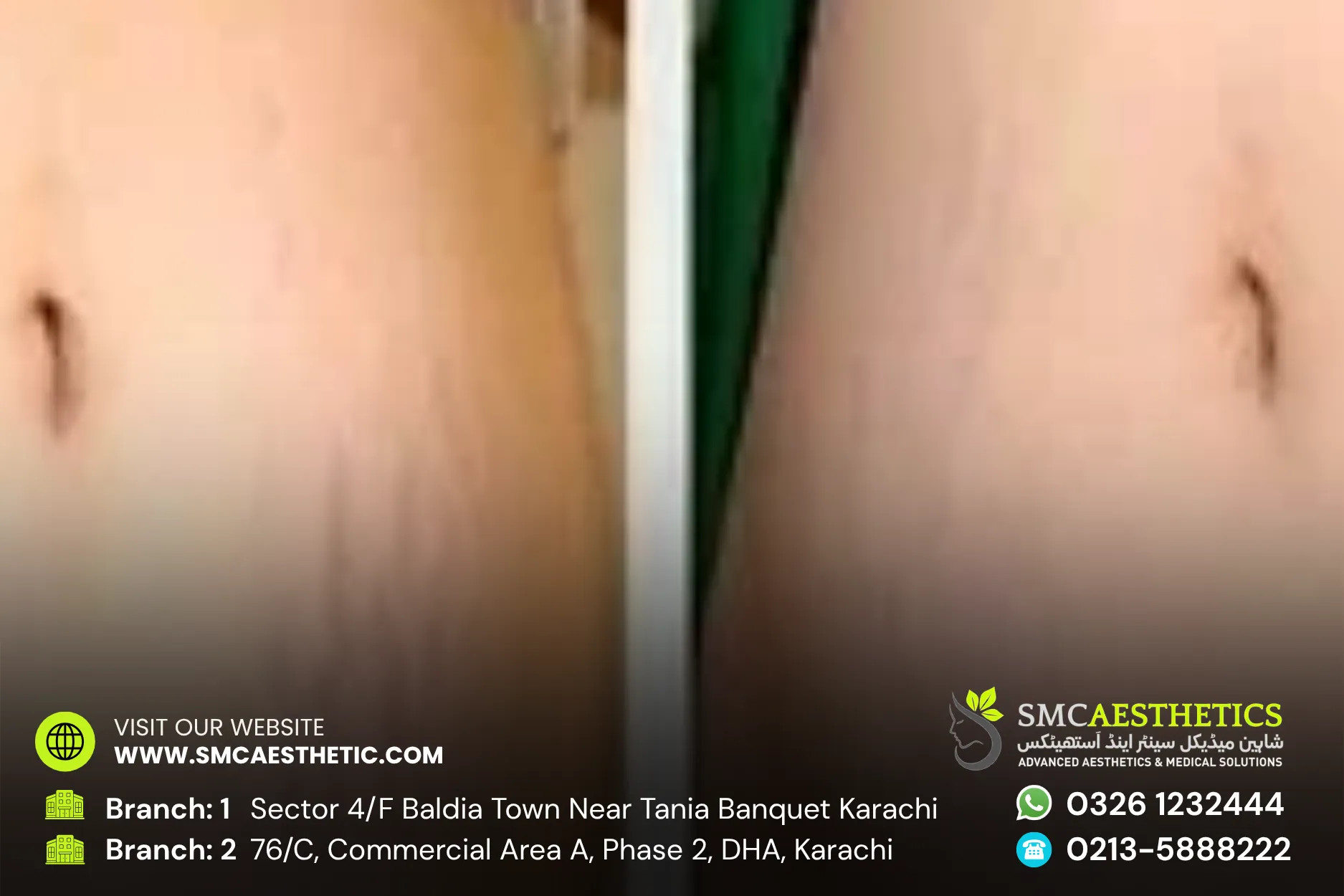 Before After Results