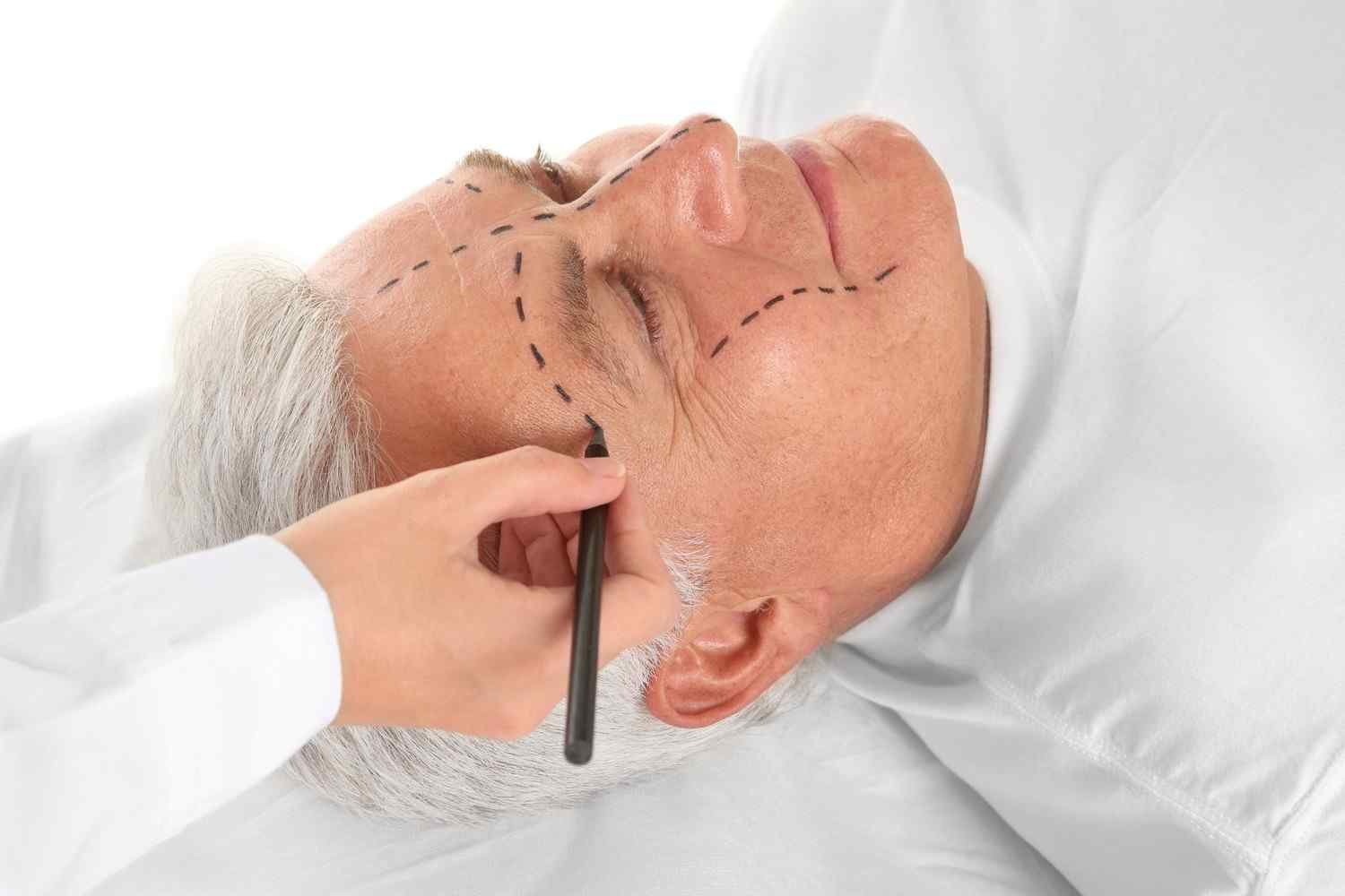 https://smcaesthetic.com/testing/wp-content/uploads/2017/08/cosmetic-surgery-blog-03.jpg