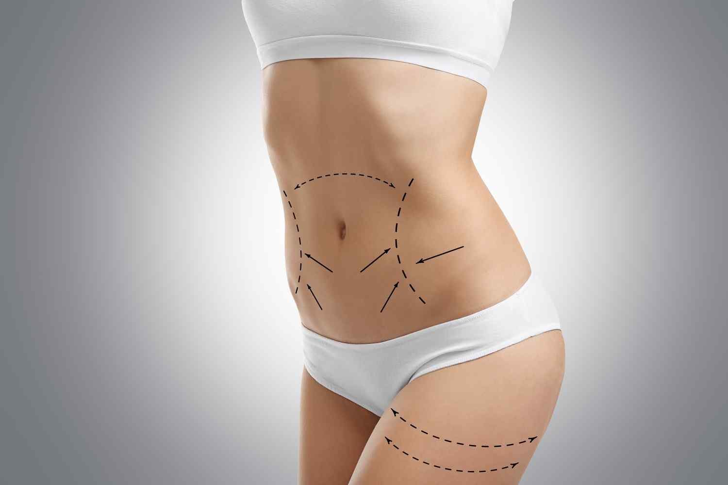 https://smcaesthetic.com/testing/wp-content/uploads/2017/08/cosmetic-surgery-blog-06.jpg