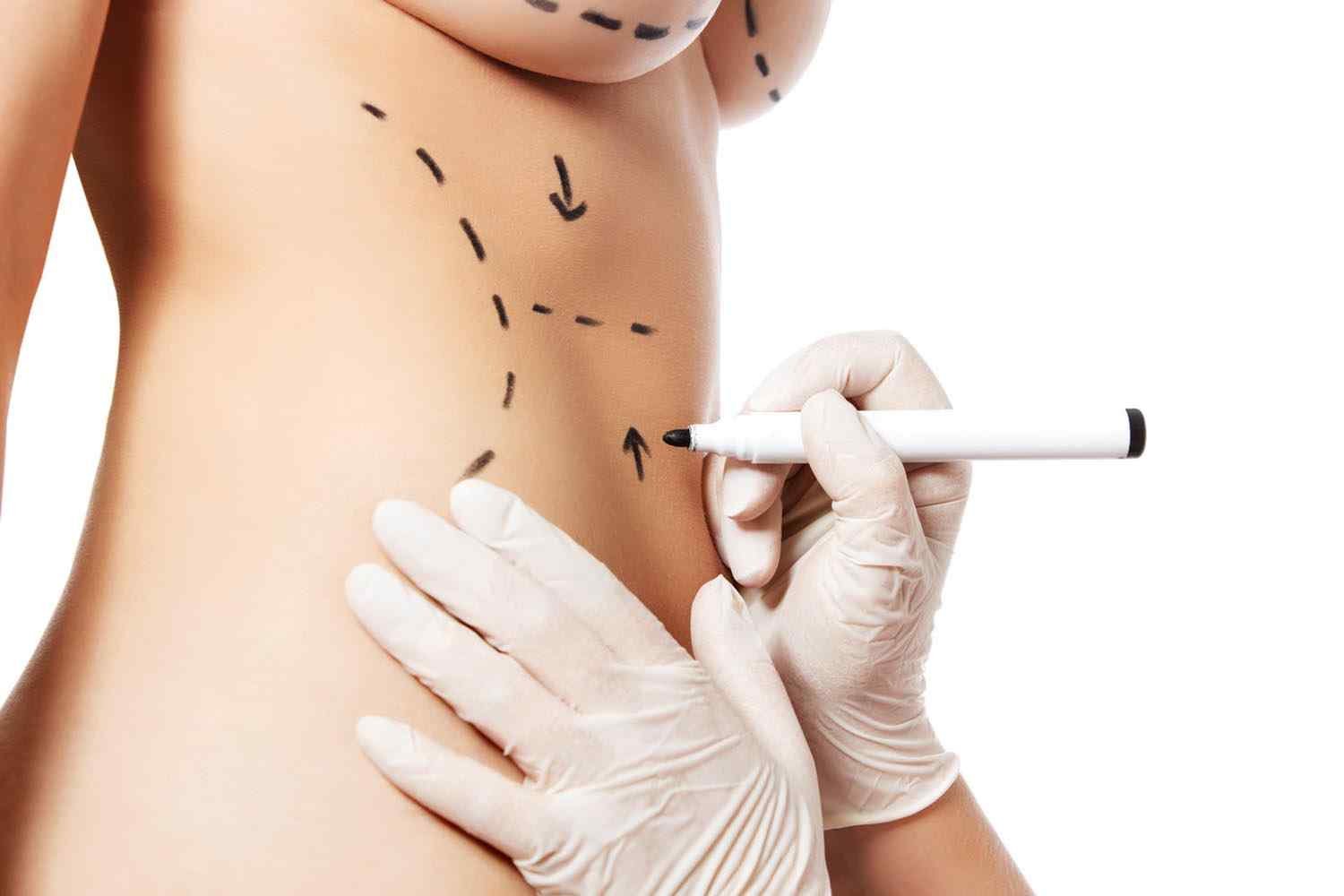 https://smcaesthetic.com/testing/wp-content/uploads/2017/08/cosmetic-surgery-blog-11.jpg