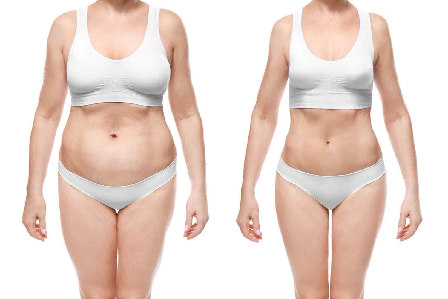 https://smcaesthetic.com/testing/wp-content/uploads/2017/08/cosmetic-surgery-blog-24.jpg